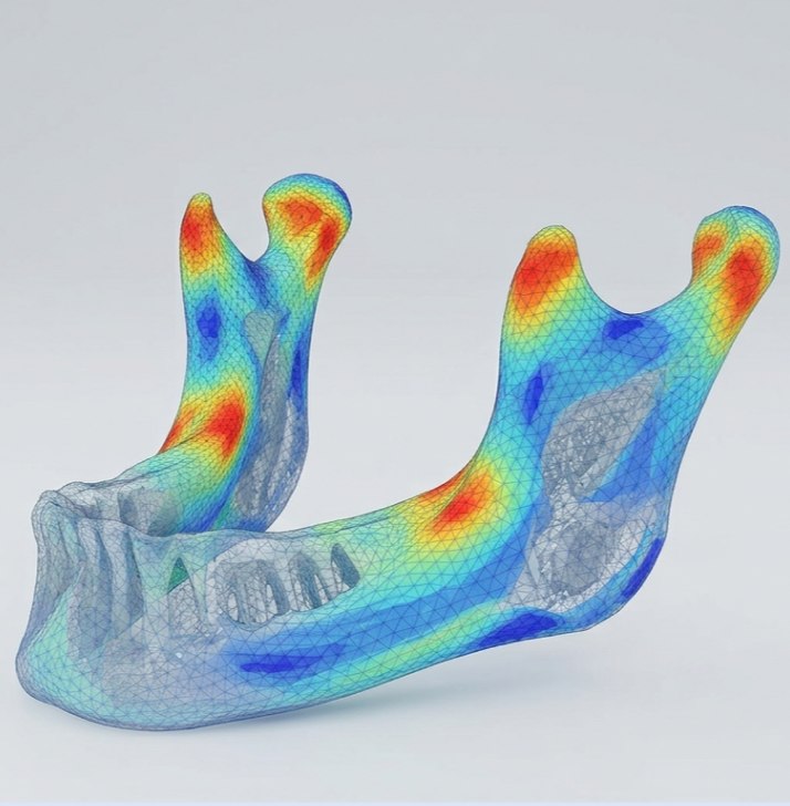 Mandibula üzerinde sonlu elemanlar analizi