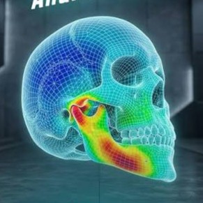 Dental model üzerinde implant planlaması